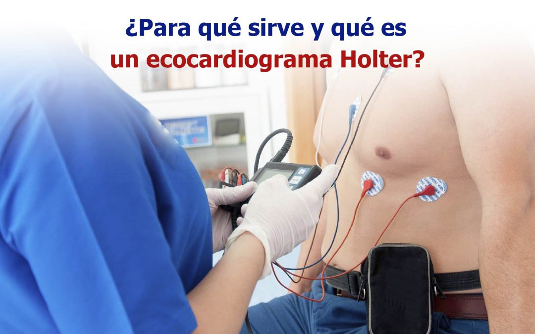 ¿Para qué sirve y qué es un ecocardiograma Holter?